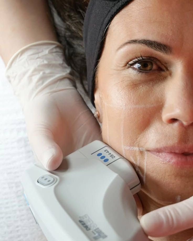 Harmonização facial INKA